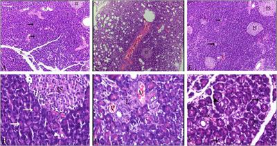 Sitagliptin ameliorates L-arginine-induced acute pancreatitis via modulating inflammatory cytokines expression and combating oxidative stress
